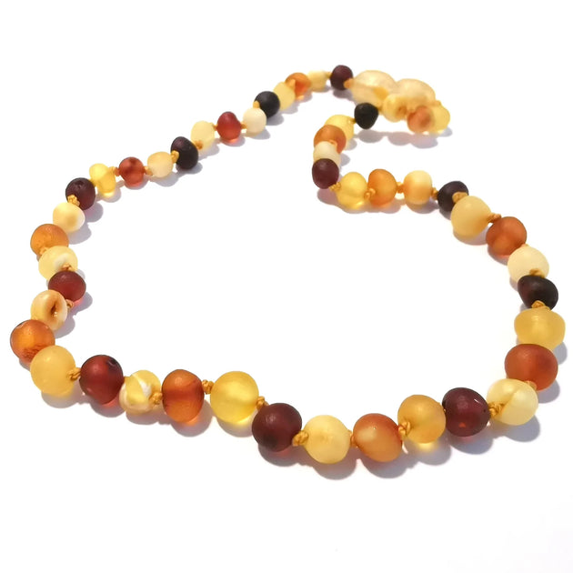 Do Amber teething necklaces work? Mile Stones Amber